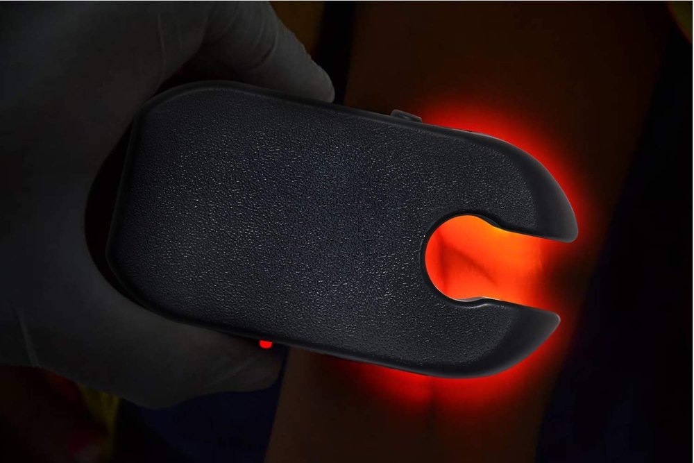 MCP Vein Finder Device for Adult and Child